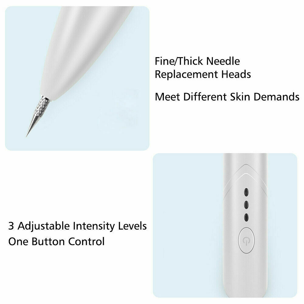Ion Laser Freckle Skin Mole Dark Spot Remover Face Wart Tag Tattoo Removal Pen Ion Laser Freckle Skin Mole Dark Spot Remover Face Wart Tag Tattoo Removal Pen